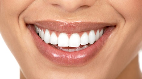 dentadura perfecta