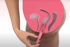 copa menstrual