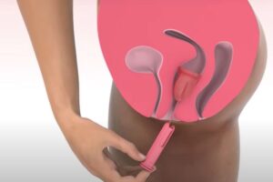 copa menstrual