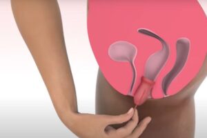 copa menstrual